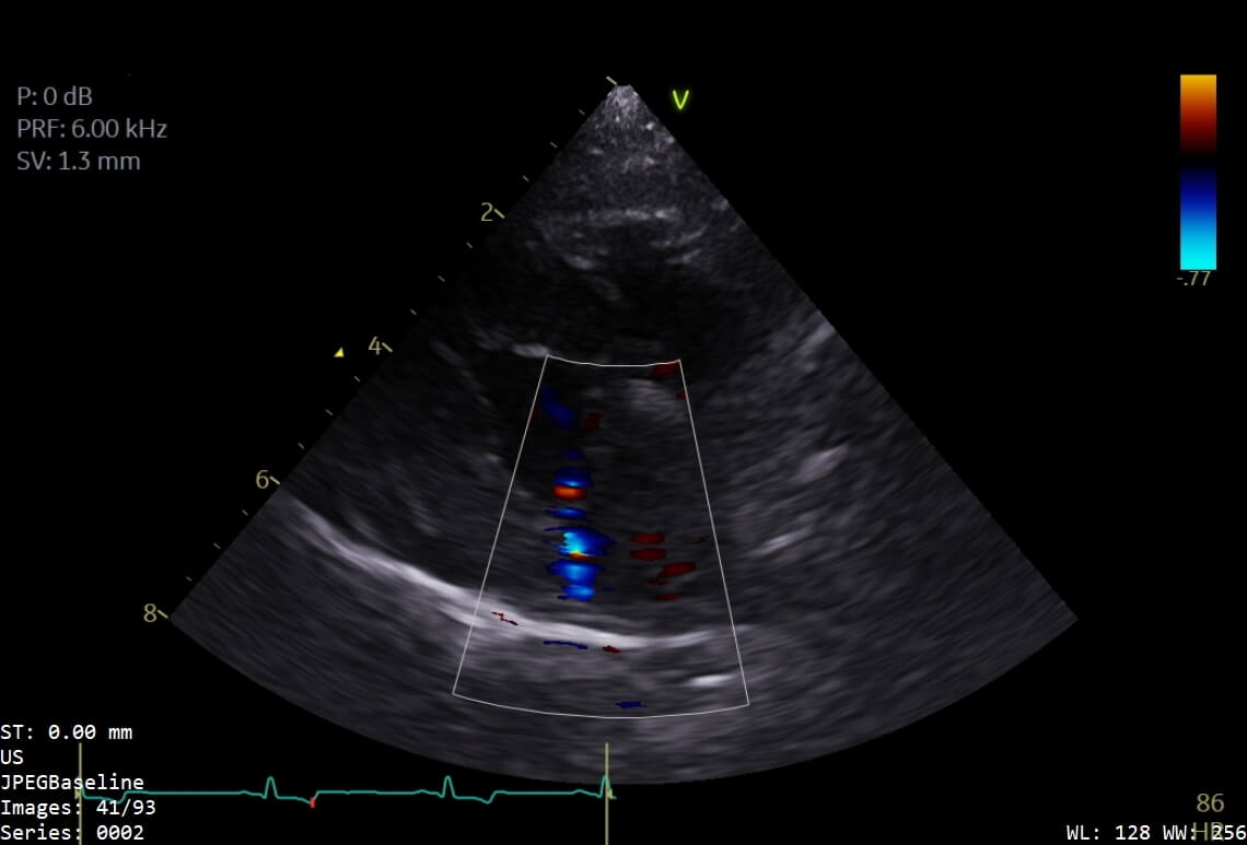 Echocardiogram scan